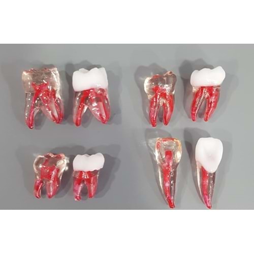 ENDODONTİK DİŞ