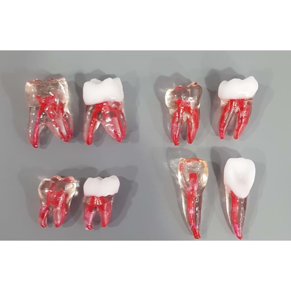 ENDODONTİK DİŞ